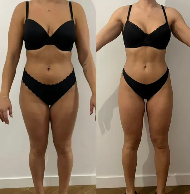 Antes y después de una clienta del método
